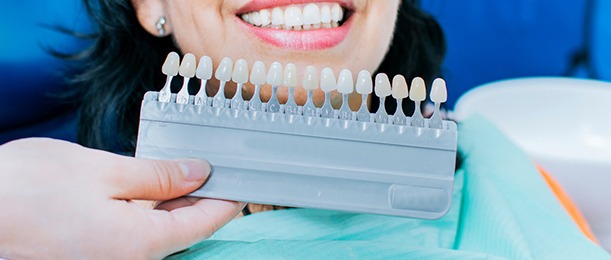 dentist holding a color matching chart up to a patient’s teeth