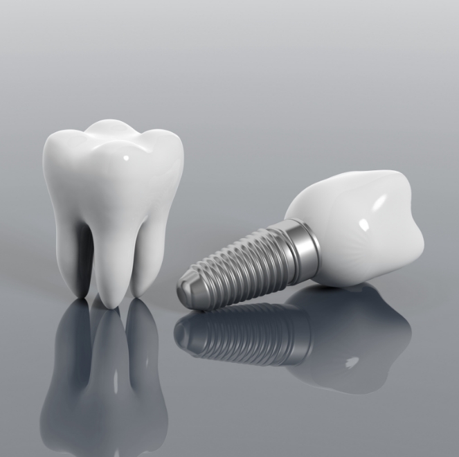 Dental Implants Jacksonville, FL Missing Teeth Dentures