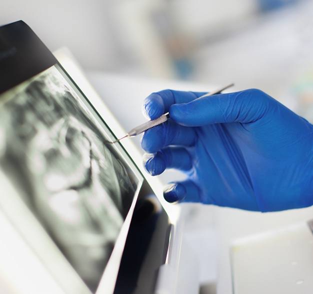 Dentist examining X-ray of patient with dental implants in Jacksonville