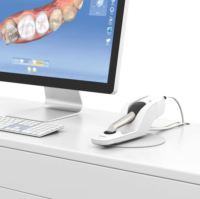 Digital impressions of teeth and dental restorations
