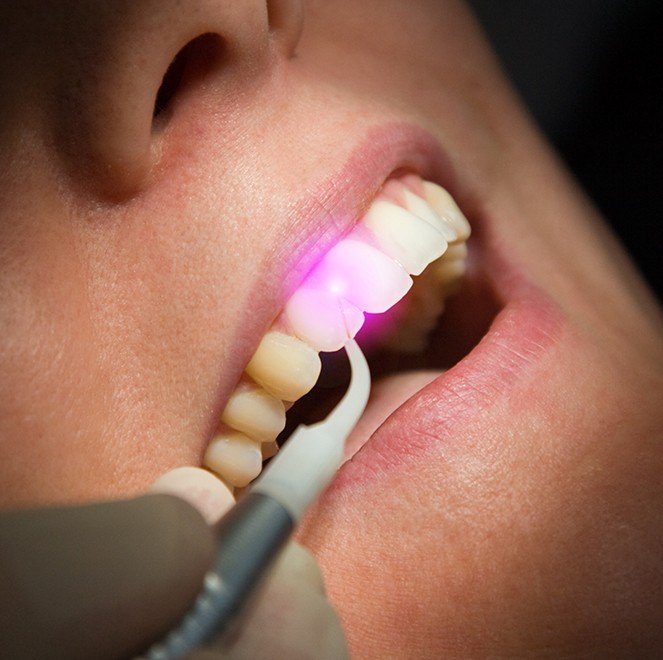 Woman receiving laser dentistry treatment