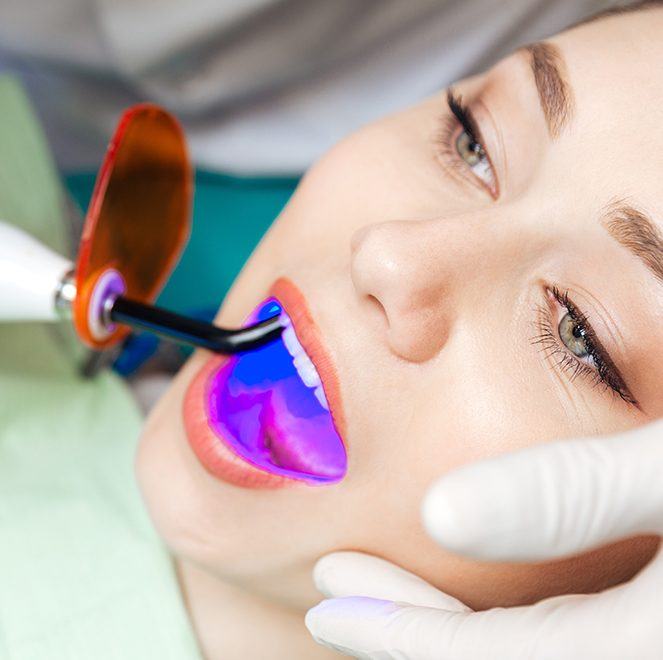 Woman receiving dental sealants