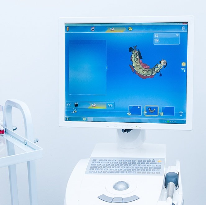 Digital impressions and dental restoration design on computer screen