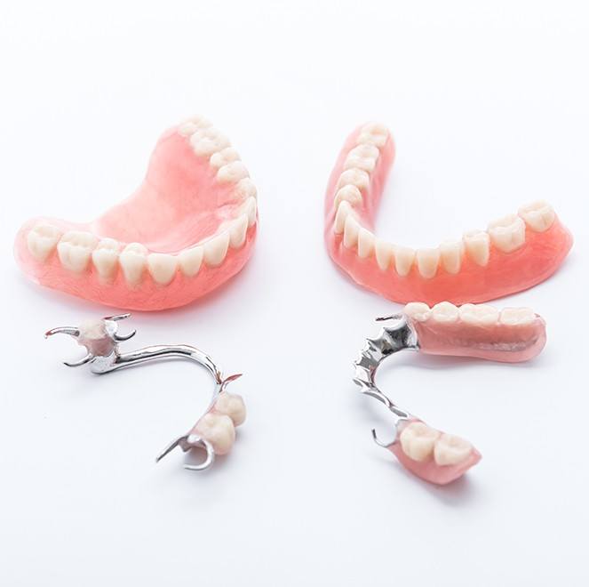 Four types of dentures