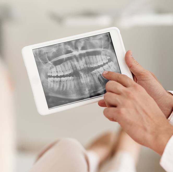 Digital dental x-rays on tablet computer