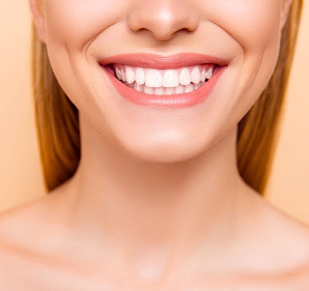 Closeup of woman smiling with veneers