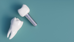 a closeup of a model of dental implants