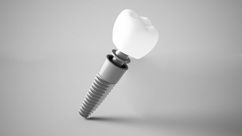 3-D diagram of a dental implant